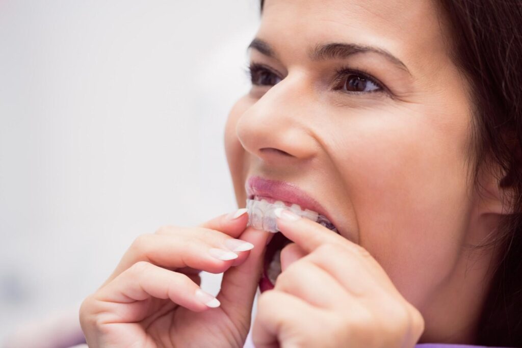 Best Invisalign Clear Aligners Clinic in Noida