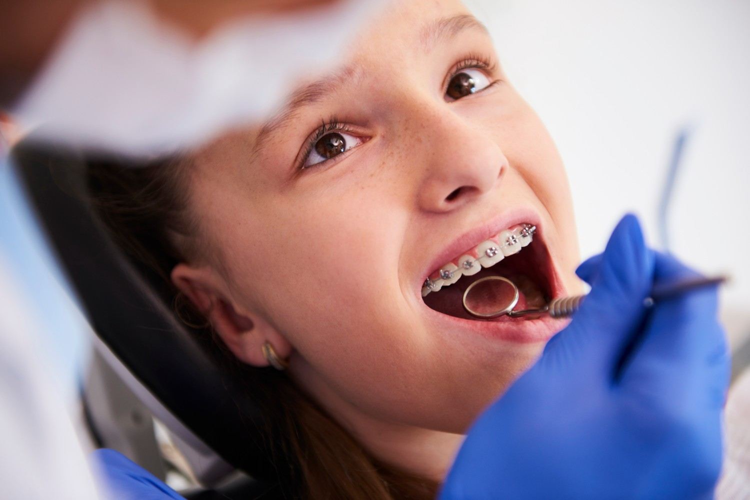 Orthodontist in Delhi NCR