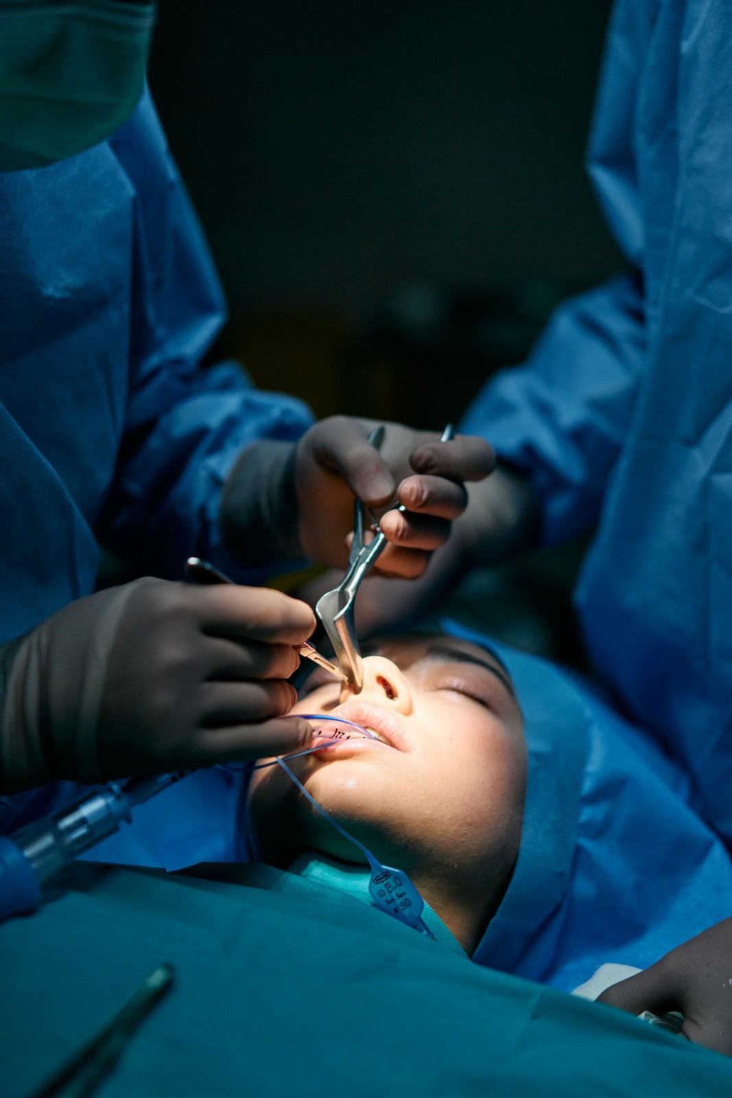 Maxillofacial Surgeon in Delhi NCR