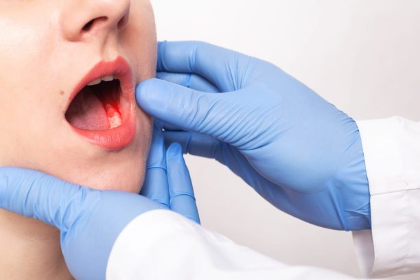 OralCancer_June.jpg.optimal-min
